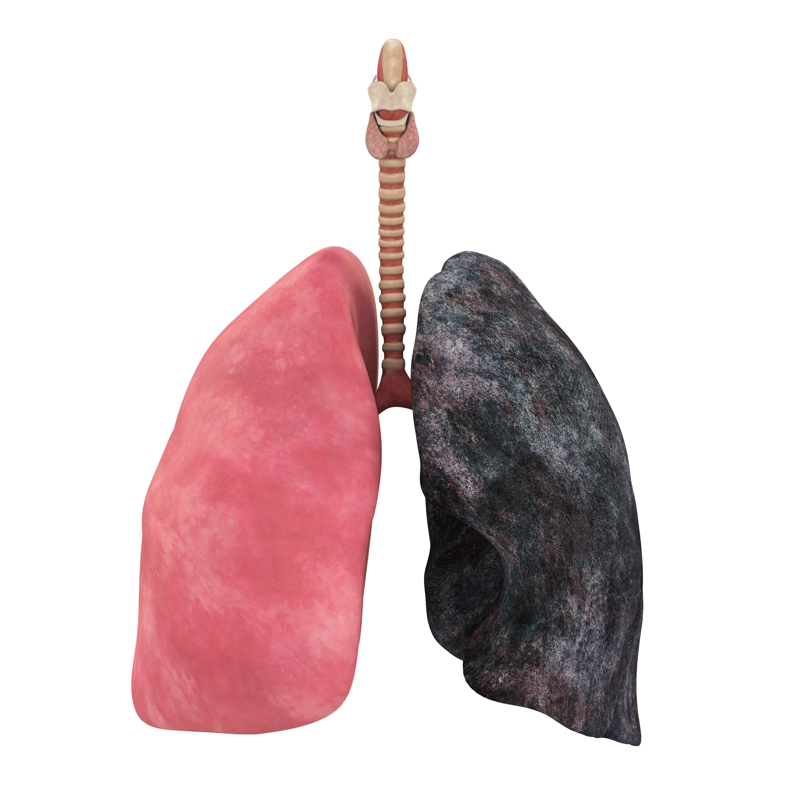 En frisk lunga och en sjuk lunga